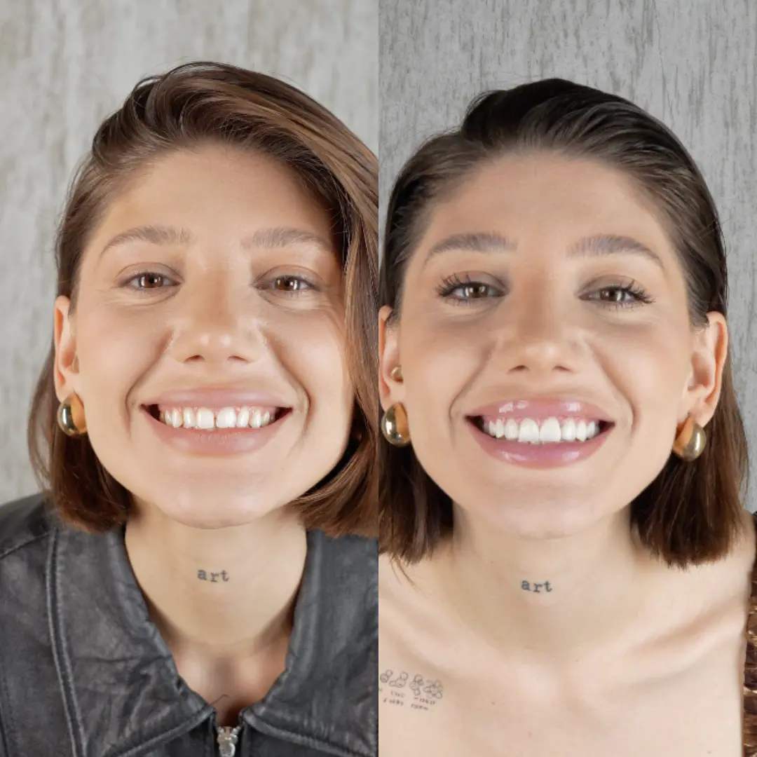 DENTAL TREATMENT